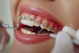 Orthodontics