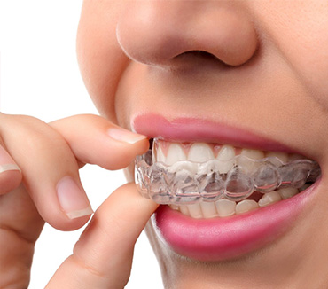 orthodontic-treatment